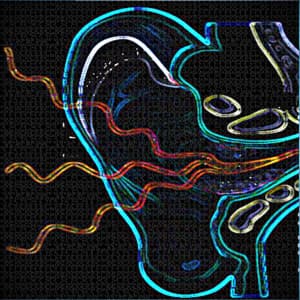 Tinnitus - MediSpa